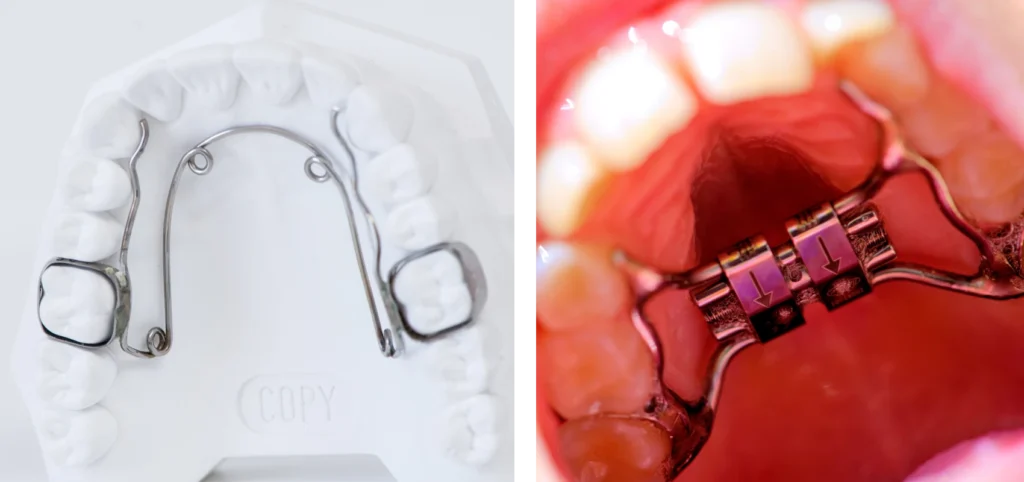 Orthodontie à Troyes - Cabinet Au fil du sourire Orthodontie enfant